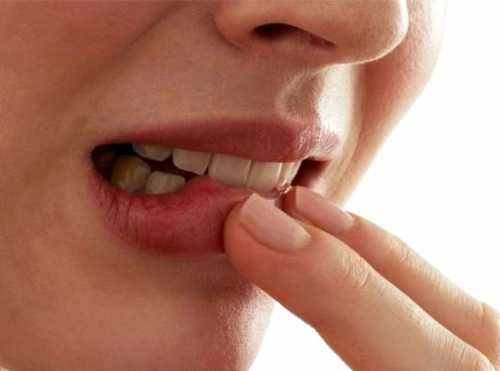 При этой болезни нетолько нарушается эстетика улыбки, поскольку зубы расходятся веером, ноиздоровые зубы приходится удалять